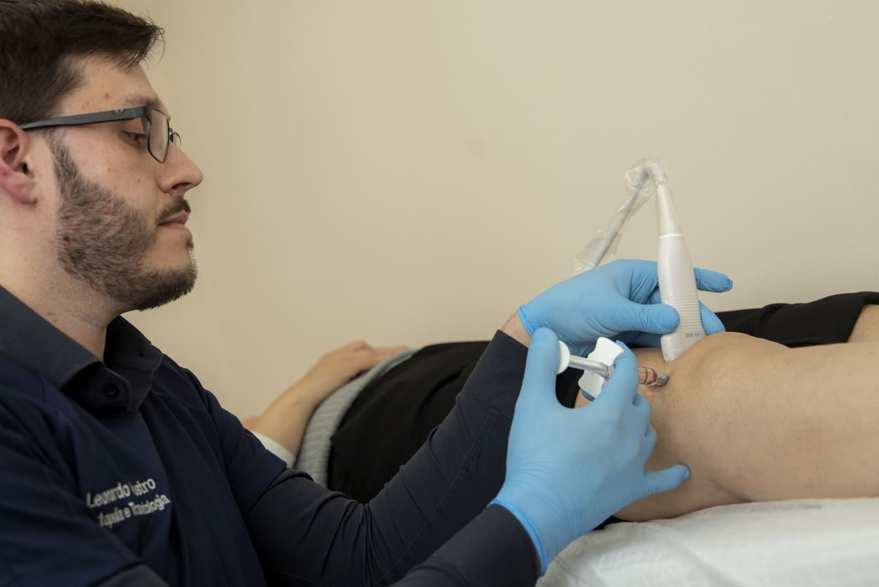 Aplicação de ácido hialurônico no joelho guiada por ultrassom para artrose, em Curitiba