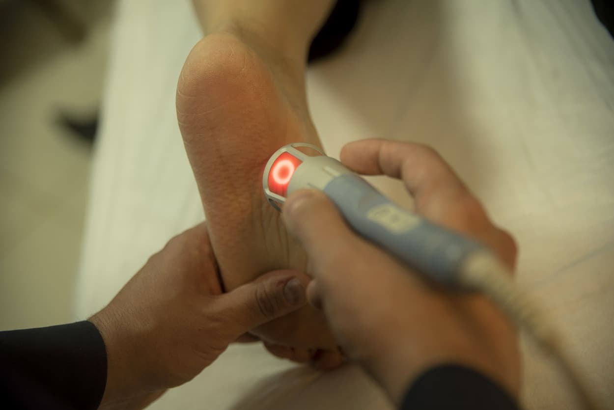 Laser de alta potência aplicado no calcanhar para fascite plantar